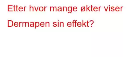 Etter hvor mange økter viser Dermapen sin effekt?