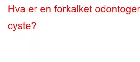 Hva er en forkalket odontogen cyste