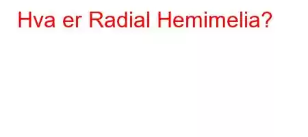 Hva er Radial Hemimelia