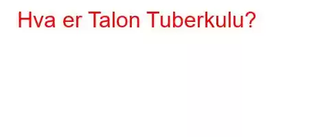 Hva er Talon Tuberkulu?