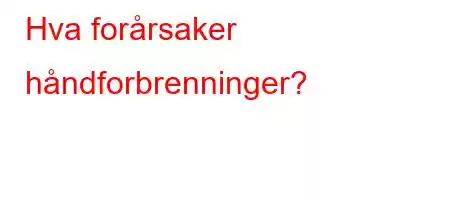 Hva forårsaker håndforbrenninger?