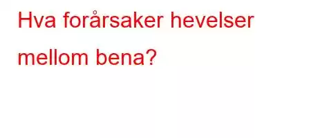 Hva forårsaker hevelser mellom bena?