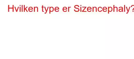 Hvilken type er Sizencephaly?